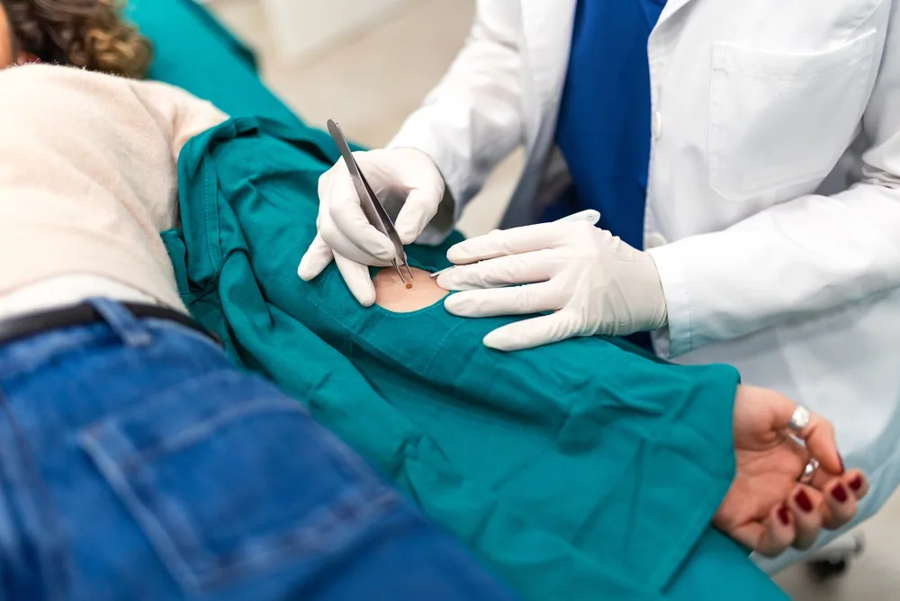 A COVID-19 test tube with a negative result is reflected on a blue surface, relevant to skin biopsy procedures at PS Dermatology and Surgery.