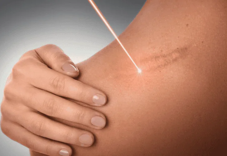 The Scars of the Job: Expert Care for Work-Related Injuries and Workers' Comp